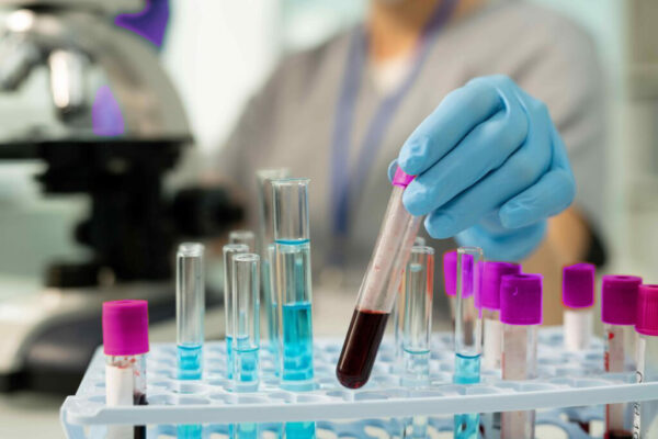 Molecular Testing